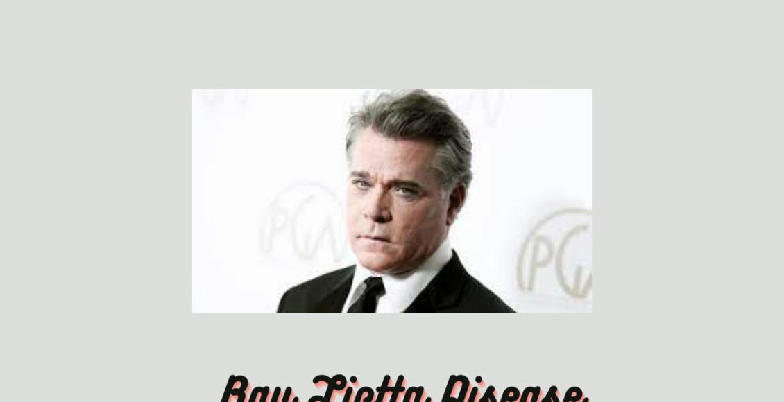 Ray Liotta Disease