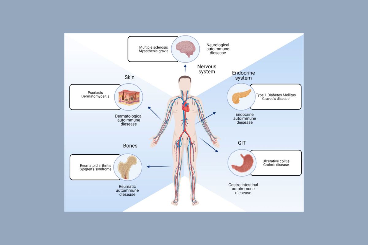 Autoimmune Disease