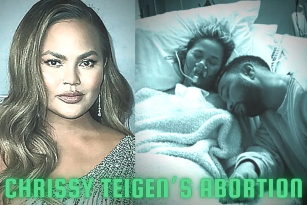 Chrissy Teigen’s Abortion