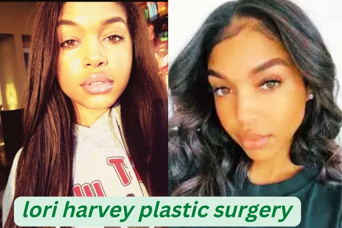 lori harvey plastic surgery