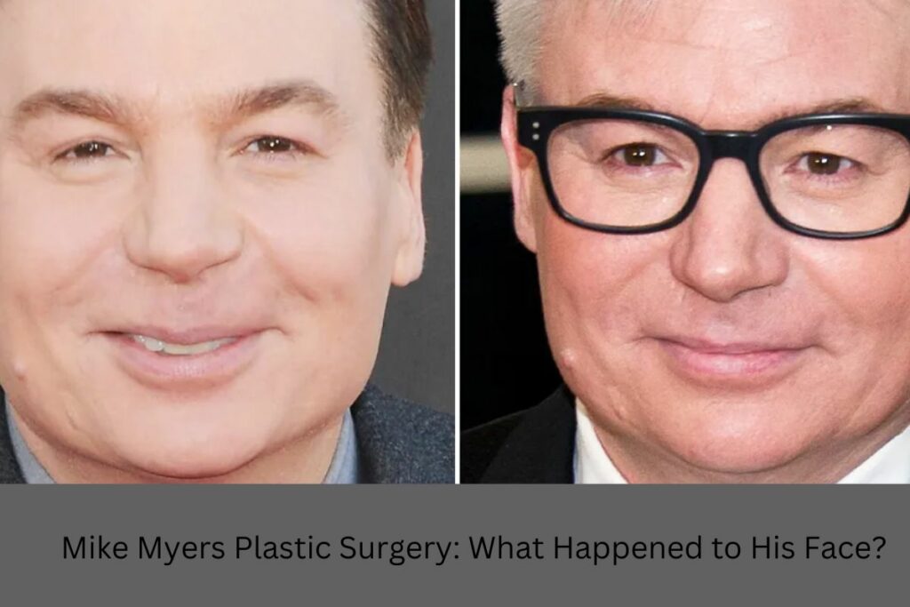 Mike Myers Plastic Surgery