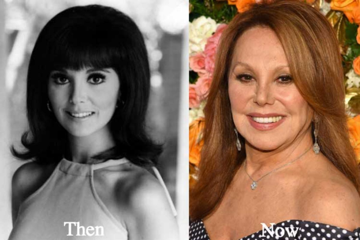 What Happened to Marlo Thomas Face?