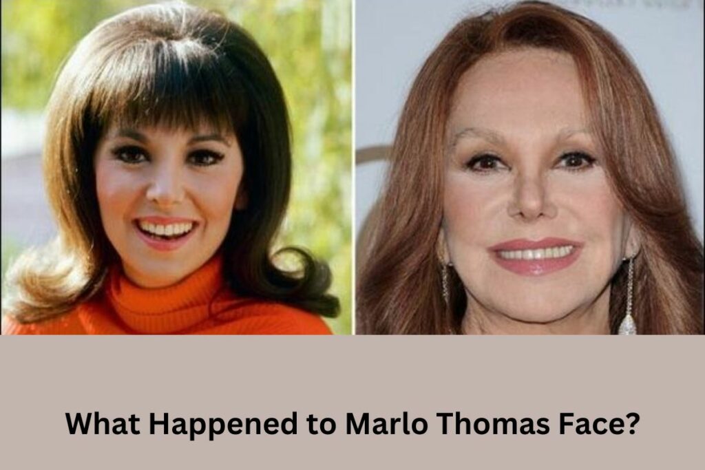 What Happened to Marlo Thomas Face?