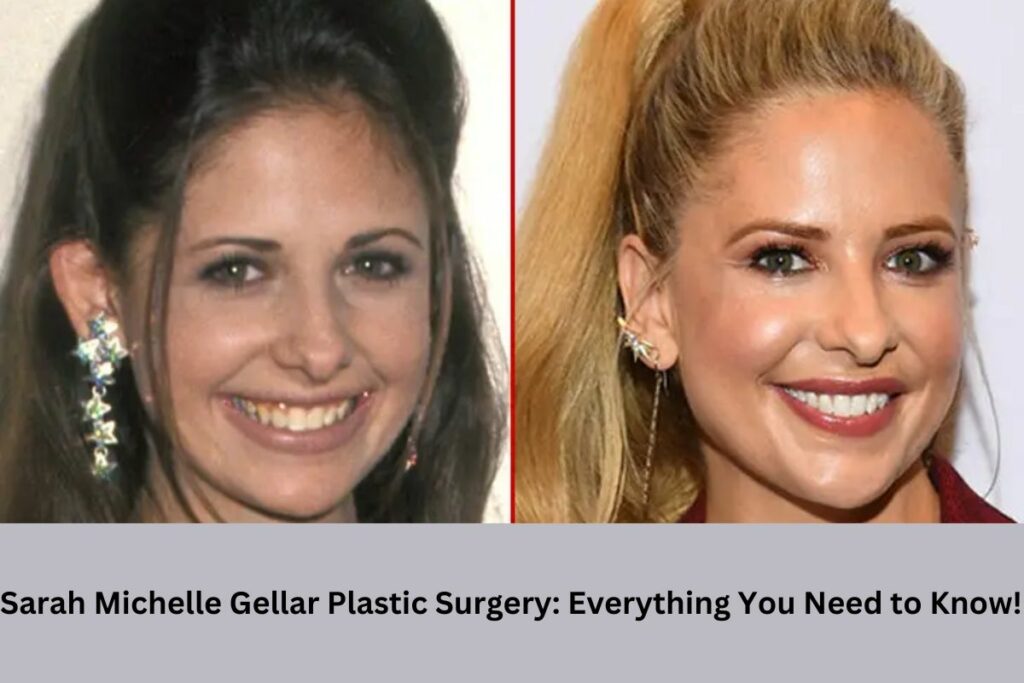 Sarah Michelle Gellar Plastic Surgery