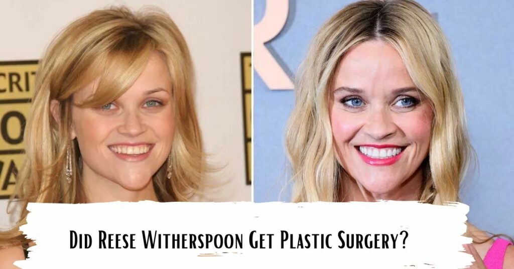 Did Reese Witherspoon Get Plastic Surgery