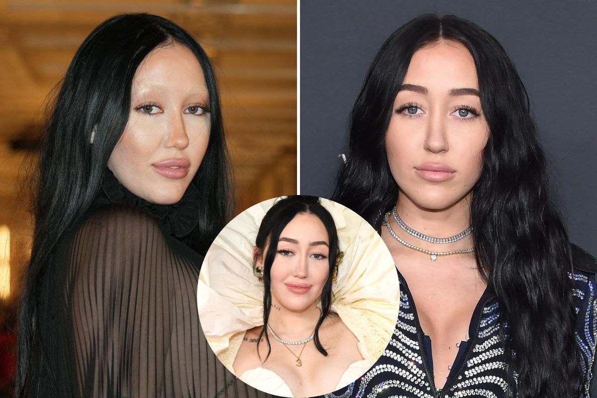 What Happened to Noah Cyrus's Eyebrows? Everything Need to Know