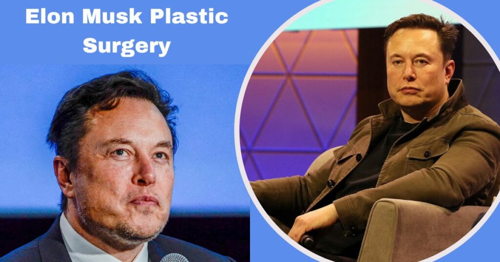 Elon Musk Plastic Surgery